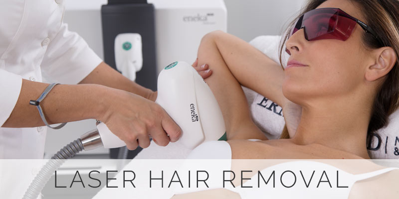 Laser-Hair-Removal
